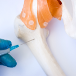 immedicohospitalario_un-hidrogel-inyectable-potencia-la-regeneracion_55224_18165957